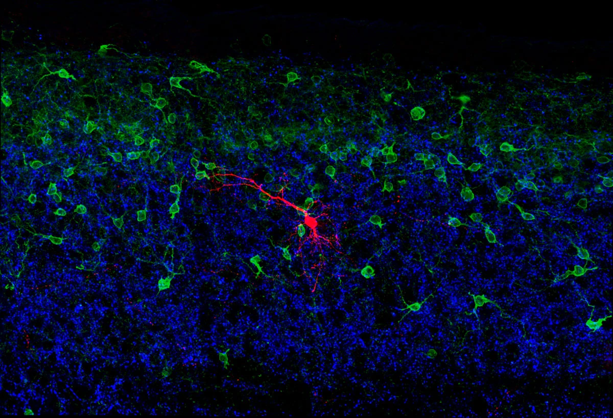 Scientists have mapped a cluster of neurons that aid our understanding of what keeps us from falling over (Image: Steeve Bourane/Salk Institute for Biological Studies)