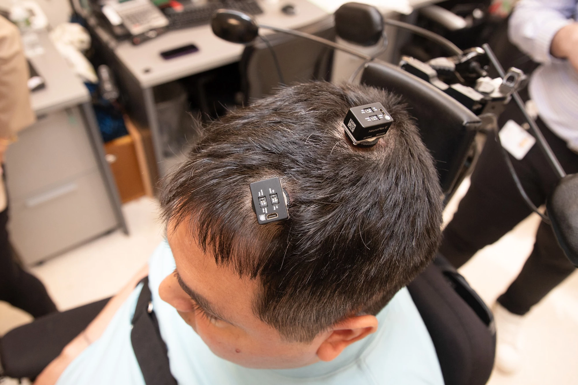 Keith Thomas had five tiny microchips implanted in his brain, forming a critical portion of the double neural bypass, which uses AI to decode and translate his thoughts into actions and stimulate his brain and spinal cord to restore movement and feeling in his arm and hand