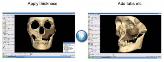 S. Bell: CAD process showing the addition of tabs for attachment to the skull