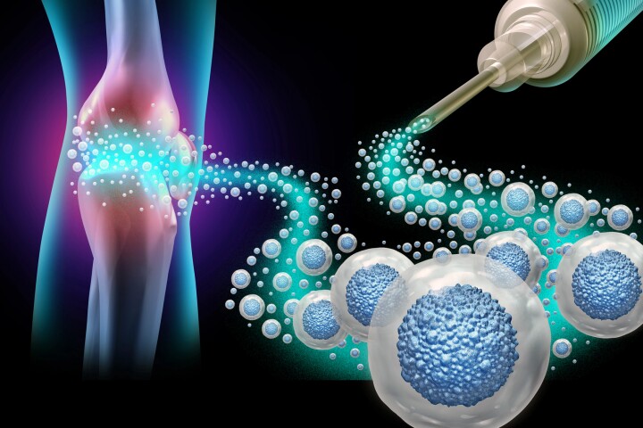 Injecting regulatory T cells (Tregs) directly into injured tissue greatly boosted healing