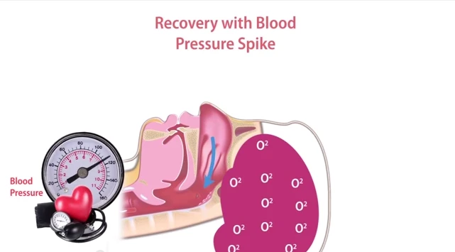 Sleep apnea affects breathing