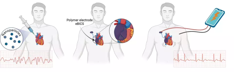 Injectable Pacemaker Regulates Heartbeat for Five Days, Then Dissolves ?url=http%3A%2F%2Fnewatlas Brightspot.s3.amazonaws.com%2F6c%2Fb4%2F7b71375741c495a2d5ad662e2706%2Finjectable Pacemaker