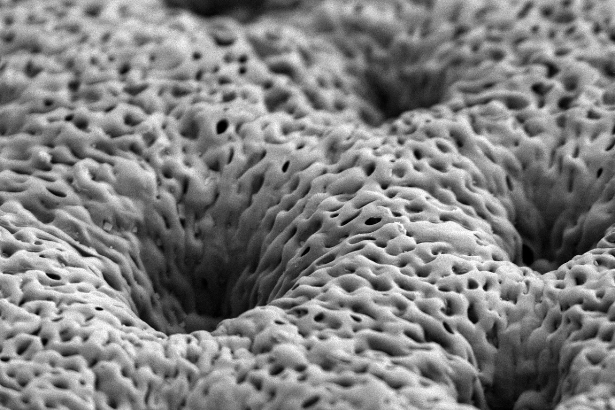 MIT's porous tissue scaffold, as imaged by an electron microscope (Image: MIT)