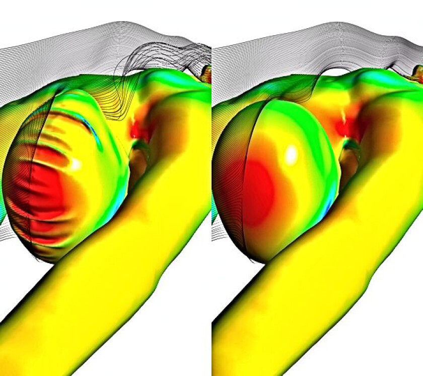 Fastskin3 Cap (right) with hair management system shapes hair for significantly improved hydrodynamics (Image: ANSYS/Speedo)
