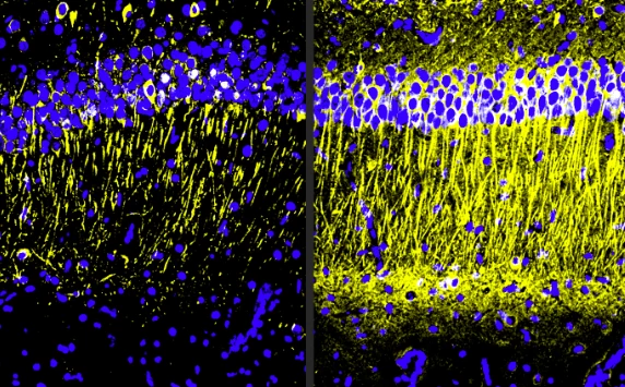 The brains of Alzheimer's model mice treated with A11 (right) showed more tubulin (yellow), a marker of neuronal health, compared to the untreated mice (left)