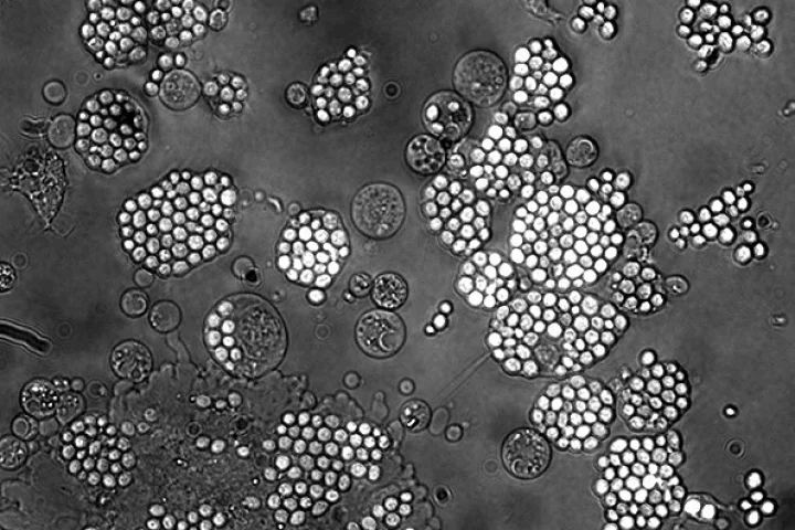 An oxygen burst released from leukocytes, magnified 20 times (Image: ESA)