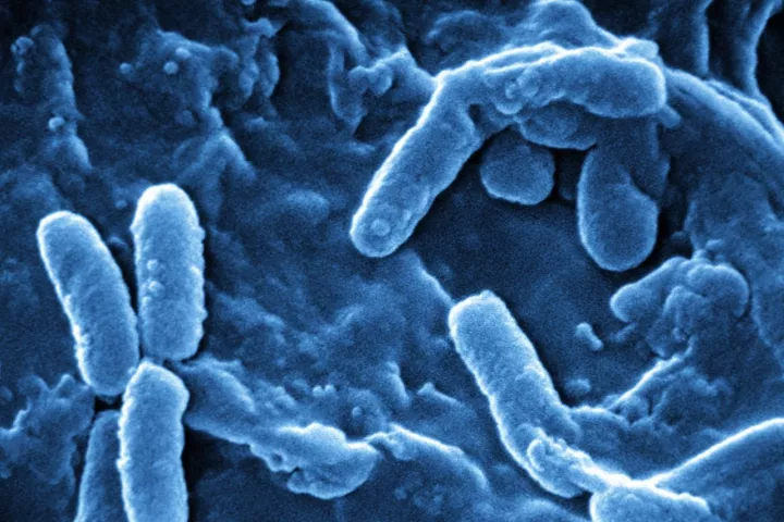Blue light has been used to kill potentially-lethal Pseudomonas aeruginosa bacteria (pictured) in the skin and soft tissues of lab mice