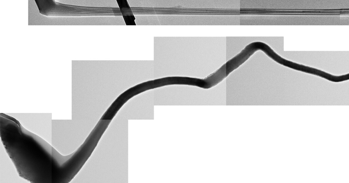 World’s smallest battery created