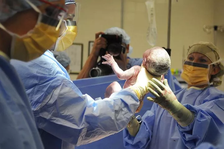 PREDIBIRTH is a software system that determines how likely pregnant women are to experience difficult labor, in order to reduce the need for emergency cesarean-sections