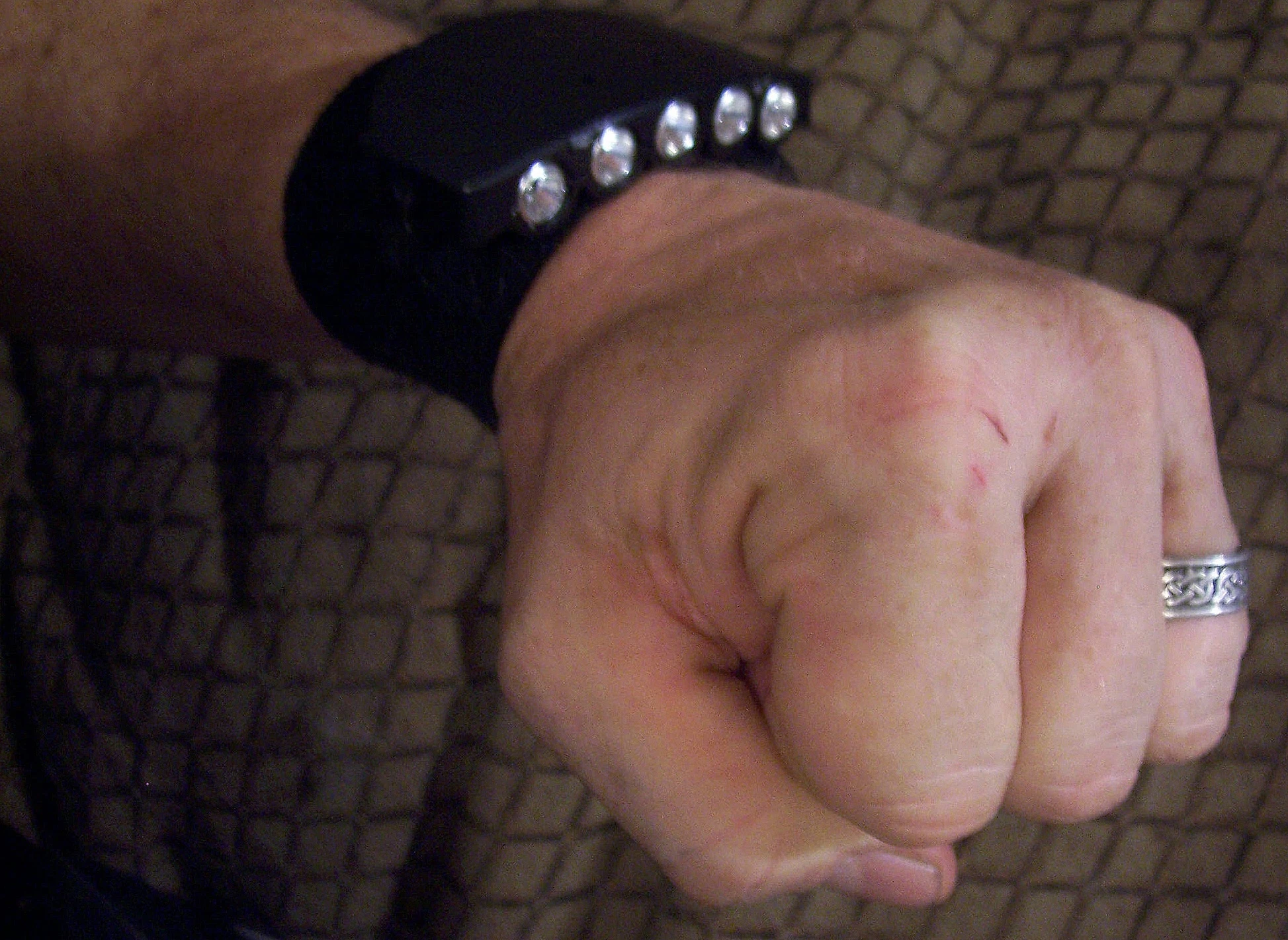 The Eye's Eyeluminator, a five-LED wrist brace