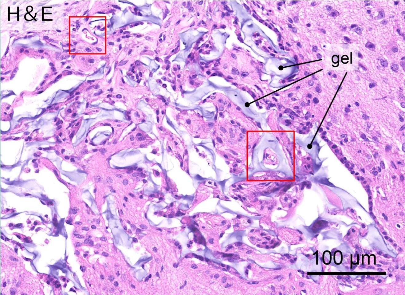 Neural stem cells, 64 days after transplantation into the hydrogel – red boxes indicate blood vessels