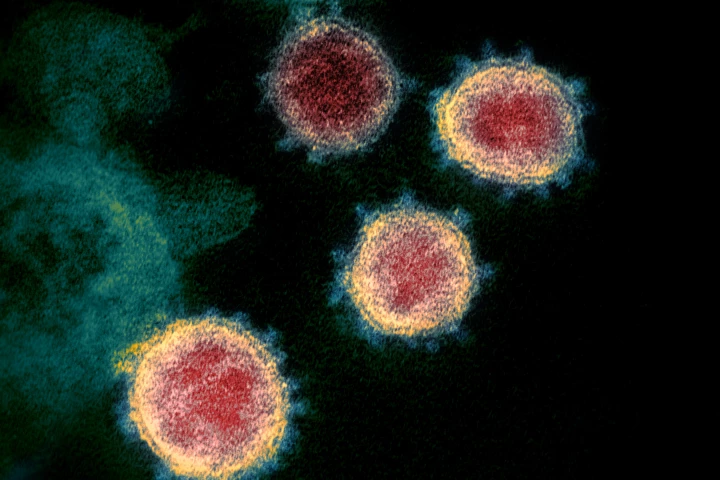 This transmission electron microscope image shows SARS-CoV-2 colorized with different tones to better highlight the crown-like spikes protruding from the surface of the virus