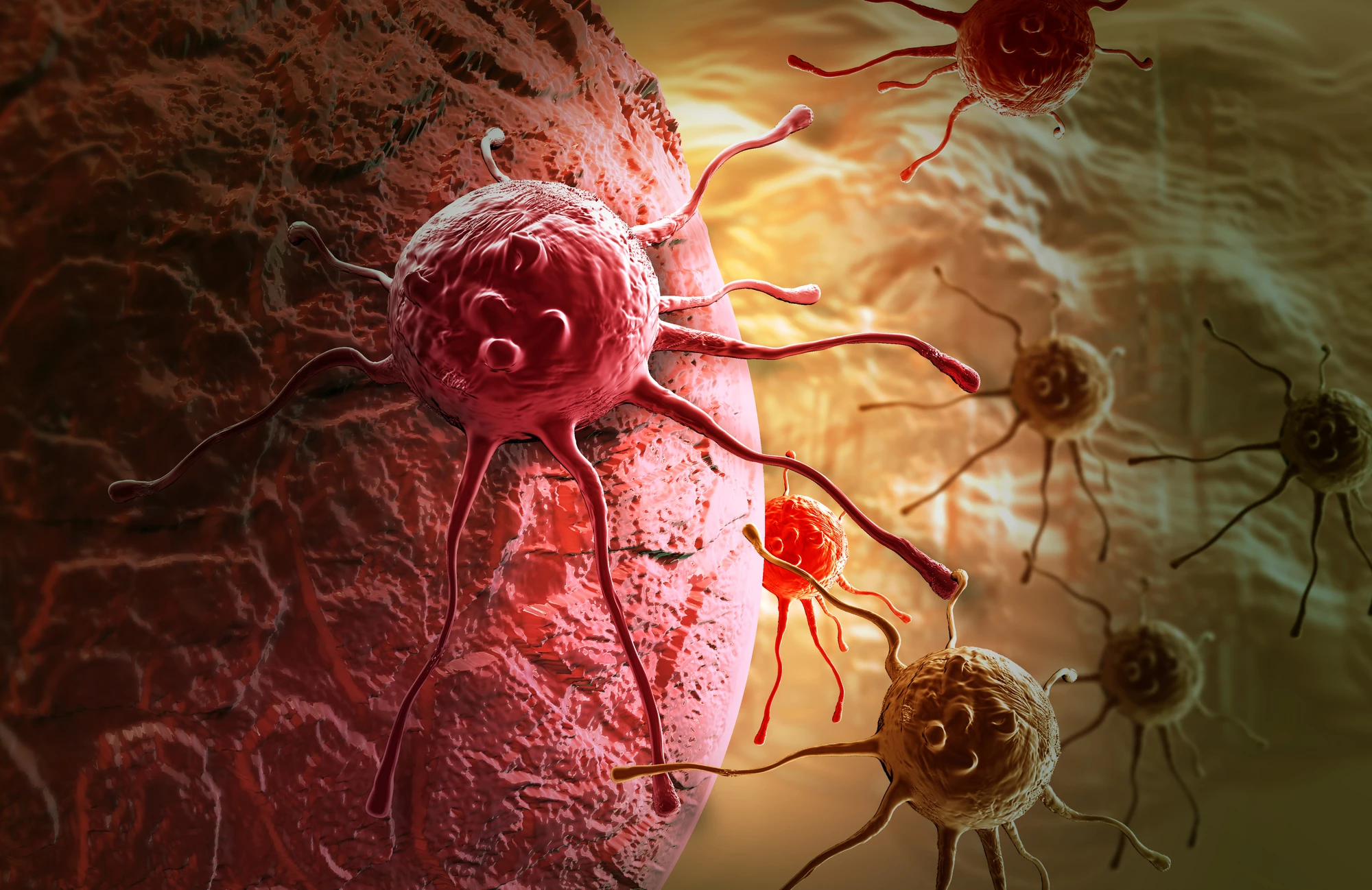A vaccine induces the body into producing antibodies that help immune cells detect and kill cancer cells