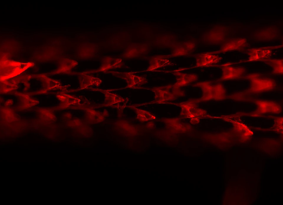 A microscope image of the barbs on the tip of a North American porcupine quill (Image: MIT)