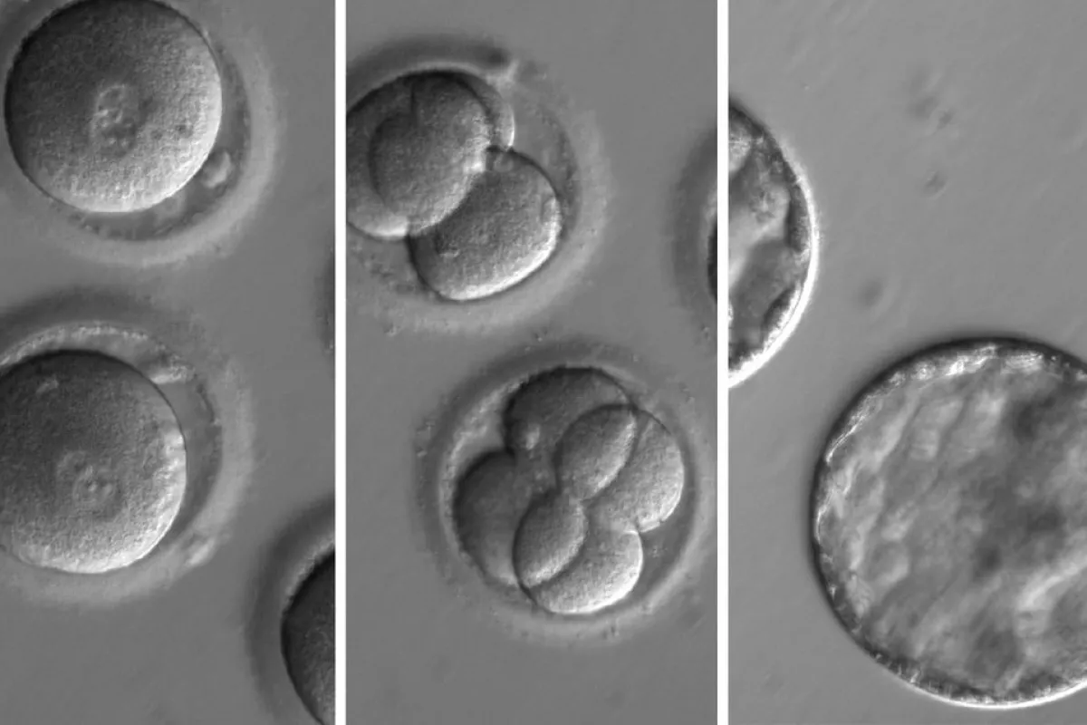 The developing embryo, which was injected with a mutation-carrying sperm and an enzyme to repair that mutation