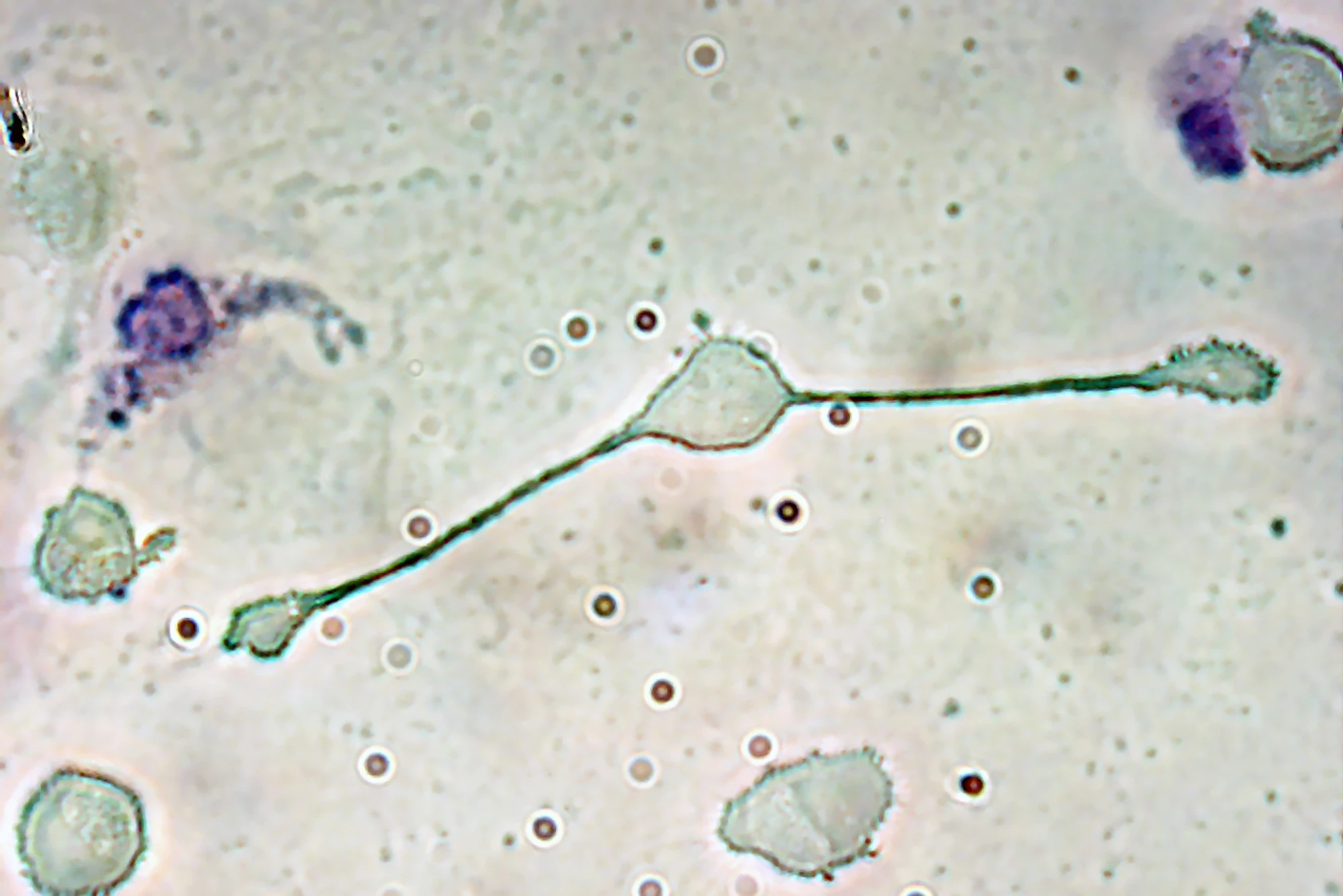 A mouse macrophage stretches itself to engulf and consume two smaller particles, probably pathogens