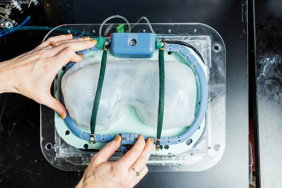 The implantable ventilator consists of two inflatable hoses (green), seen here over a model diaphragm (white)