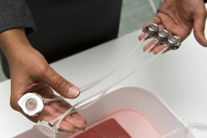 Students from Johns Hopkins University have created an implantable device, that could make dialysis treatments safer and easier (Photo: Johns Hopkins University)