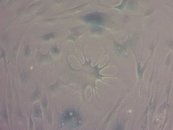 A close-up of the process of cellular senescence in human cells, a key mechanism underlying aging