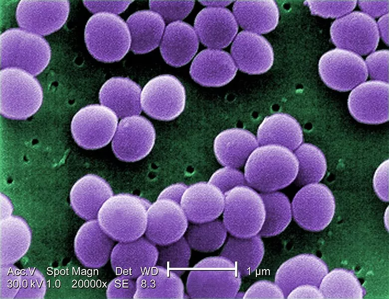IBM's "ninja polymers" are capable of killing antibiotic-resistant bacteria such as Staphylococcus aureus (pictured)