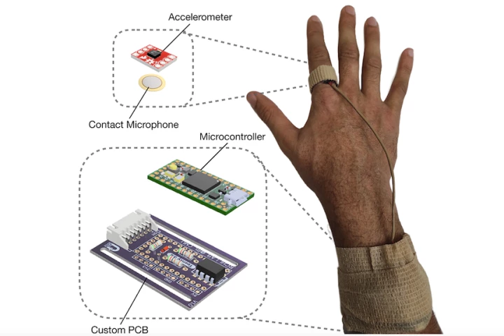A diagram of the prototype wearable device
