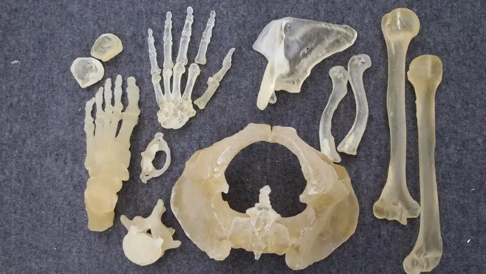 Various pieces of Caspar Berger's skeleton, reproduced from CT scan data on a 3D printer