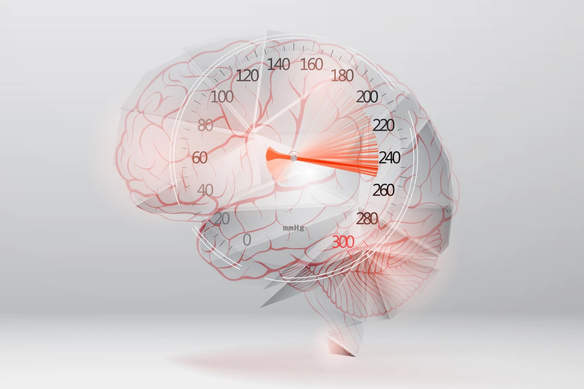Giving mice with high blood pressure human placenta cells prevented inflammation and cognitive impairment caused by the condition