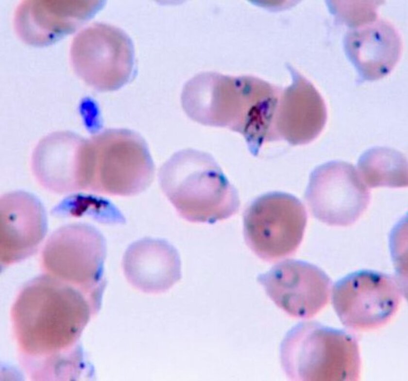 The malaria-causing Plasmodium falciparum parasites in human blood cells (Photo: US Center for Disease Control and Prevention)