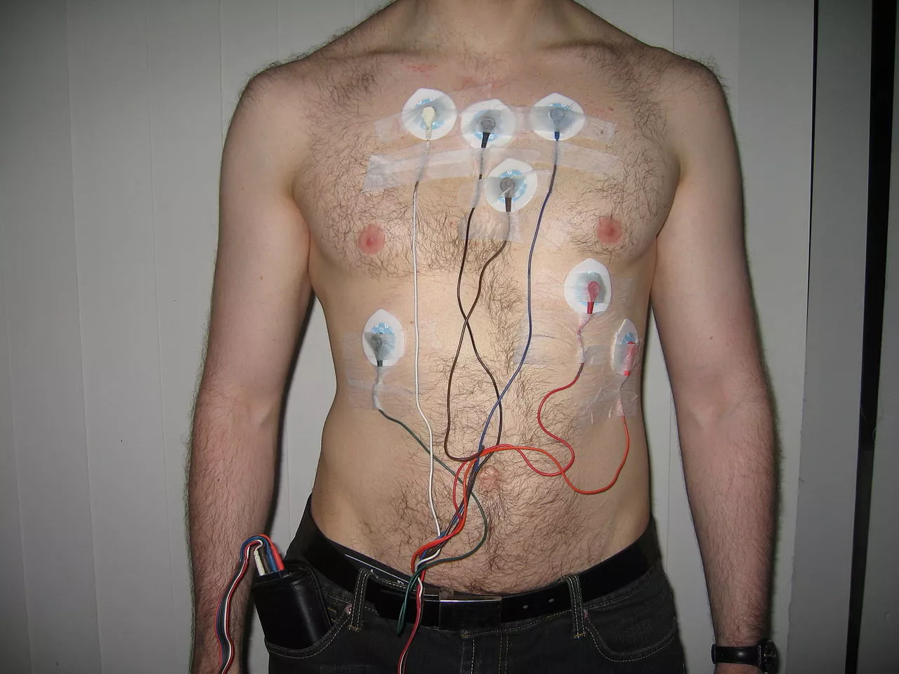 A Holter monitor setup (Photo: Jason7825)