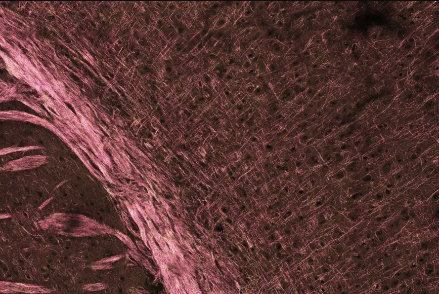 Synthetic Peptide Helps Repair Myelin Damaged By Ms