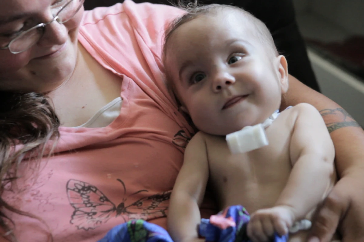 Kaiba Gionfriddo, seen here with a ventilator attachment, is the recipient of a first-of-its-kind tracheal splint