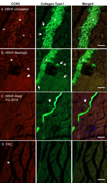 A comparison of the groups, including A) untreated rats, B) placebo rats, C) drug-treated rats, and D) control rats that hadn't performed the repetitive task