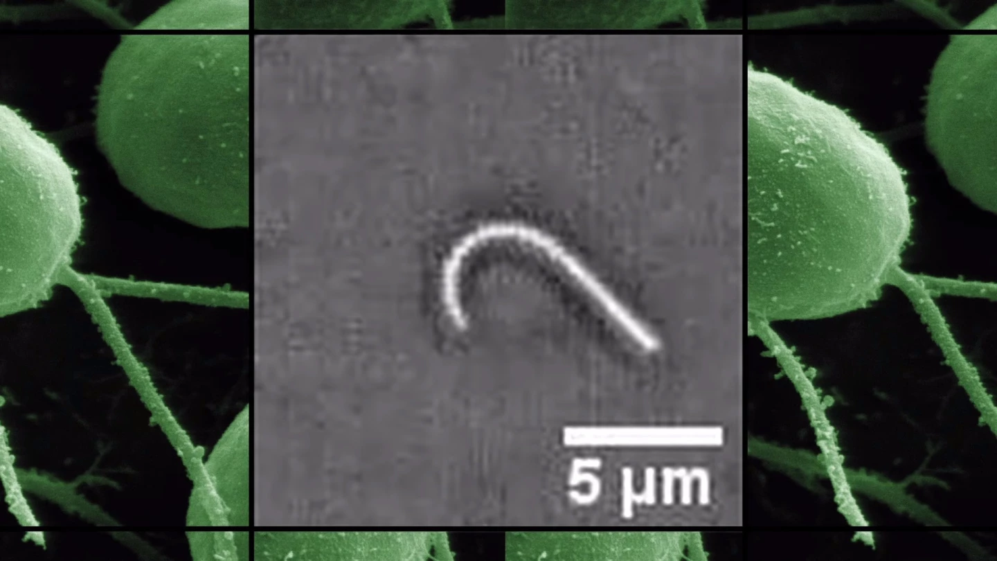 The team used video microscopy to study the motion of flagellum frame-by-frame, looking carefully at the movement of its backbone and identifying the different shapes it formed as it passed through a complete oscillatory cycle