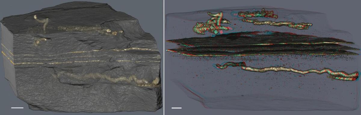 3D images show the tubes in clear detail