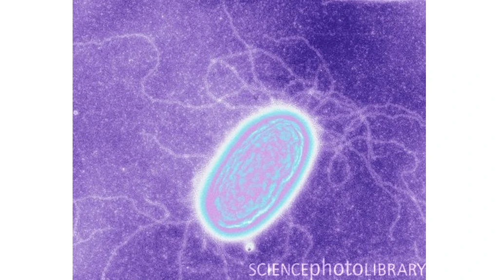 Geobacter has tiny hairlike extensions called pili that it uses to generate electricity from mud and wastewater (Image: Derek Lovely. Science Photo Library)