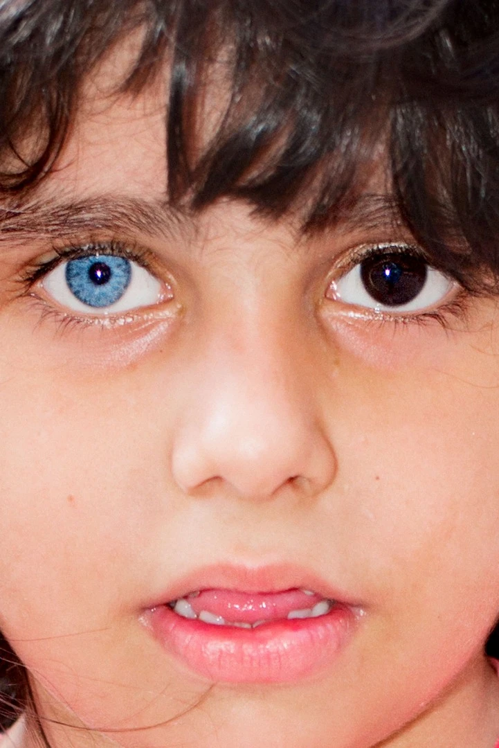 A Syrian refugee girl in Tarlabasi. She lost both her parents during the war and was taken to Istanbul by some family friends, who now take care of her. The peculiar color of her eyes according to her adoptive family is a gift of God