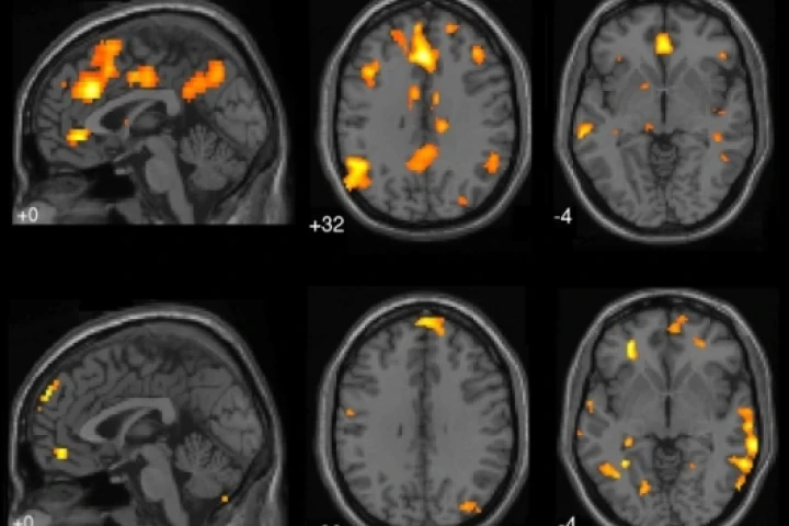 fMRI brain scans from UBC Mind Wandering Study(Image: Courtesy of Kalina Christoff)