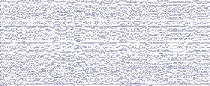 A sample EEG readout; each brain has its own unique alpha wave oscillation frequency somewhere between 8-12 Hz