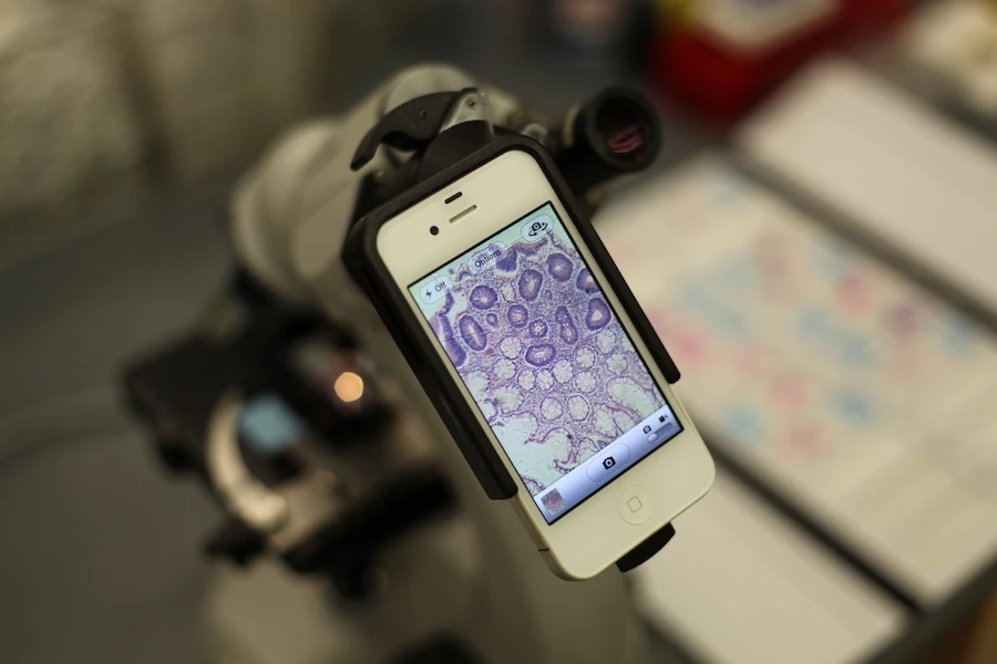 Magnifi universal photoadapter case for iPhone 4 and iPhone 4S