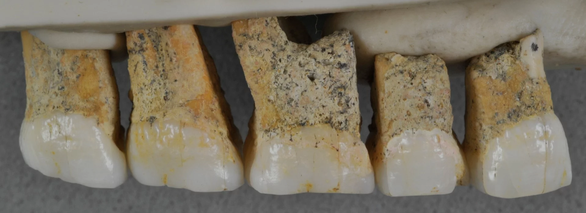 The upper teeth of one Homo luzonensis individual
