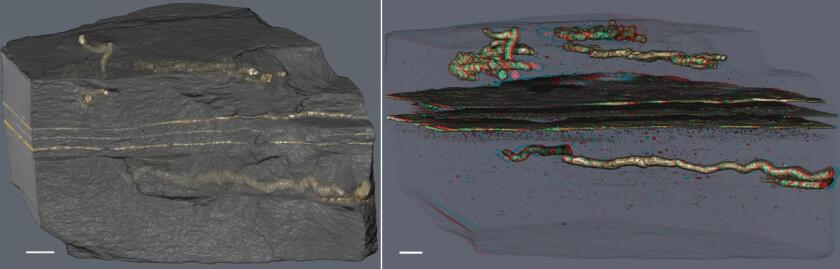3D images show the tubes in clear detail