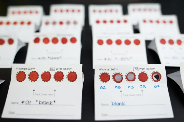 A dried blood spot analysis that can detect B12 levels has been developed