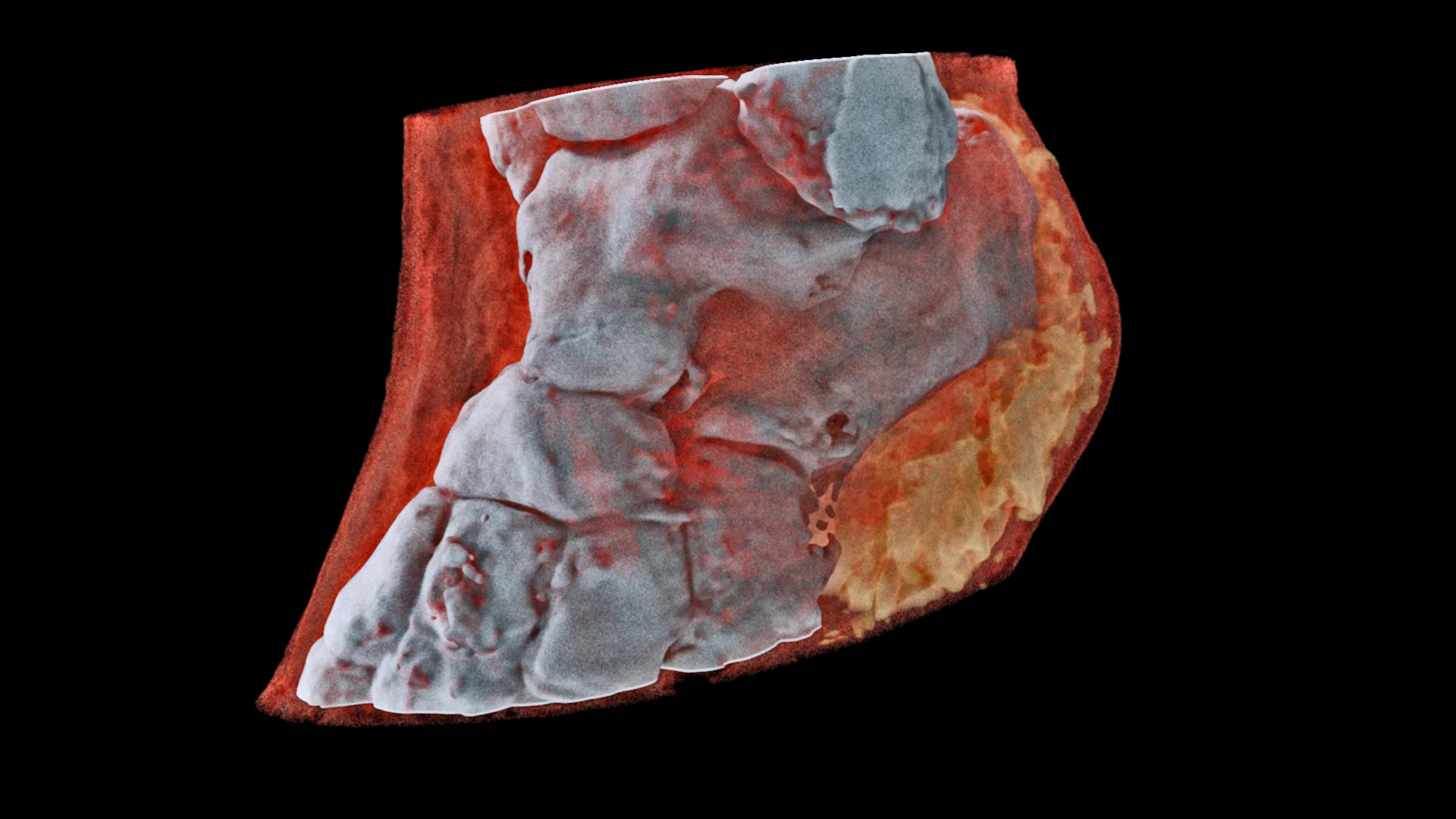 A 3D Mars image of an ankle, clearly showing bone, soft tissue and lipids