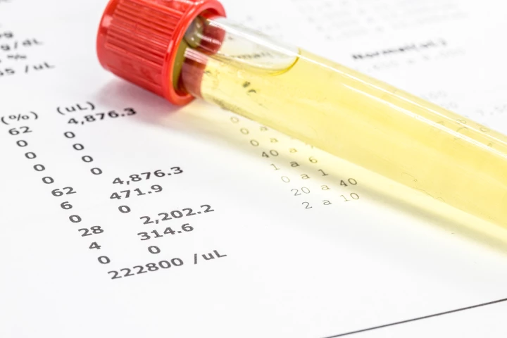 New research raises the possibility of a test that could detect Alzheimer's in its early stages