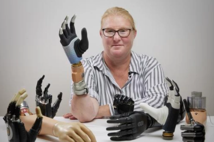 Karin's prosthesis is bionic as it is attached to her nervous system as well as to muscle and bone