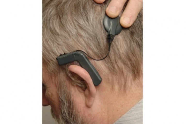 The DUET Electric-Acoustic System, or EASPhoto: UT Southwestern Medical Center