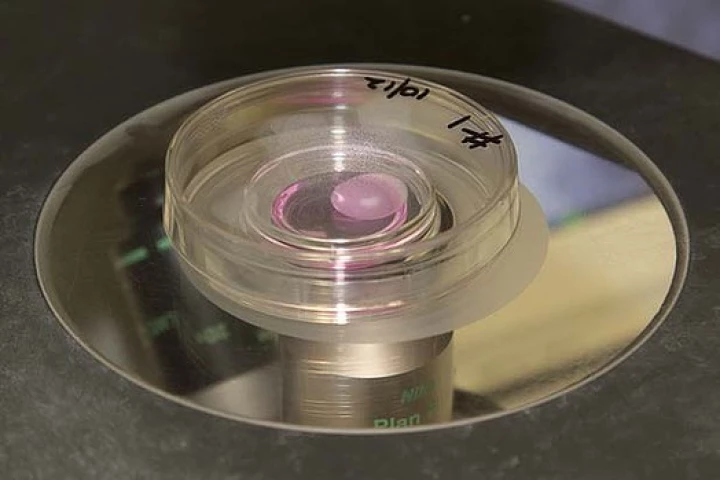 The University of Queensland mini-kidney