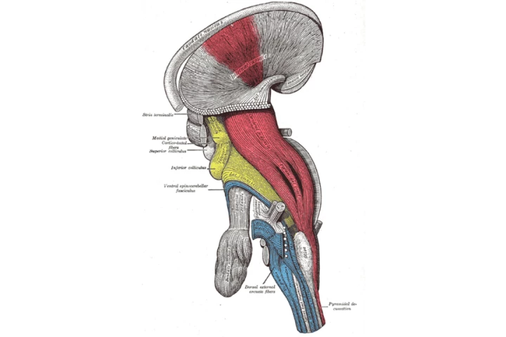 Deep dissection of brain-stem with the corticospinal tract visible in red