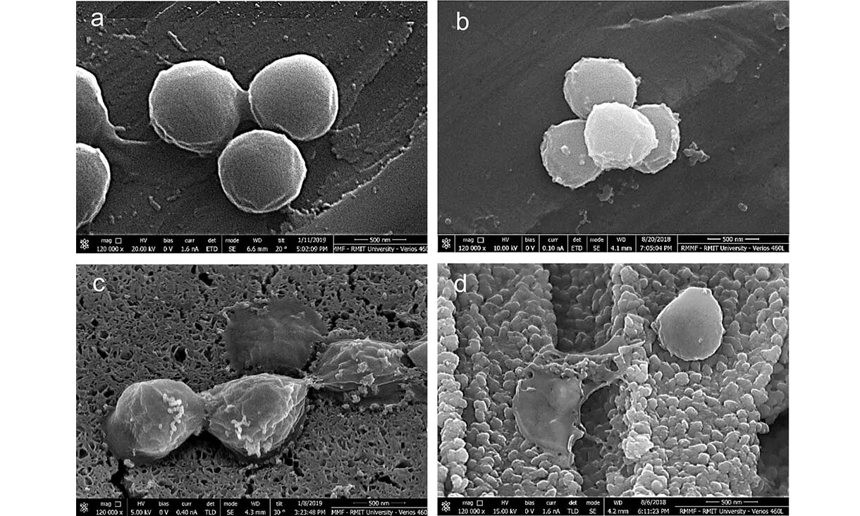 Images magnified 120,000 times under a scanning electron microscope show golden staph bacteria cells after two minutes on a) polished stainless steel, b) polished copper, and in c) and d), the new micro-nano copper surface