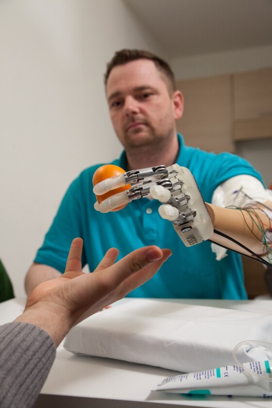 Four electrodes were implanted into the ulnar and median nerves of the arm